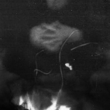 Ossadogva – Prophesy